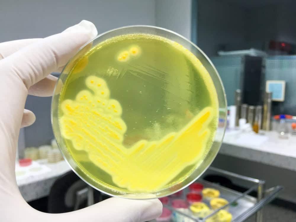 Vi khuẩn tụ cầu vàng nguy hiểm ra sao, gây bệnh gì? Cách nhận biết?