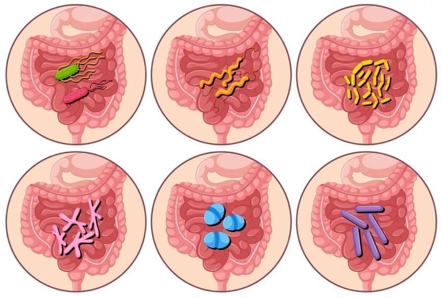 Viêm dạ dày ruột: Nguyên nhân, triệu chứng và cách điều trị