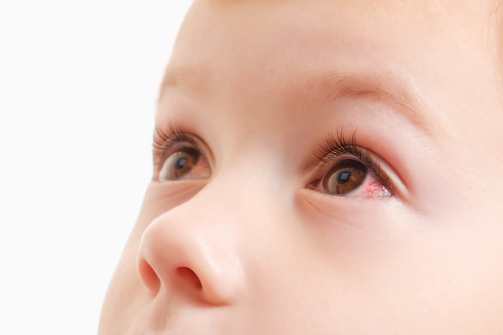 10+ bệnh về mắt thường gặp ở trẻ em và cách chăm sóc mắt cho trẻ nhỏ