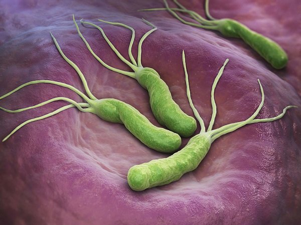 Helicobacter pylori: Kẻ thù thầm lặng của sức khỏe
