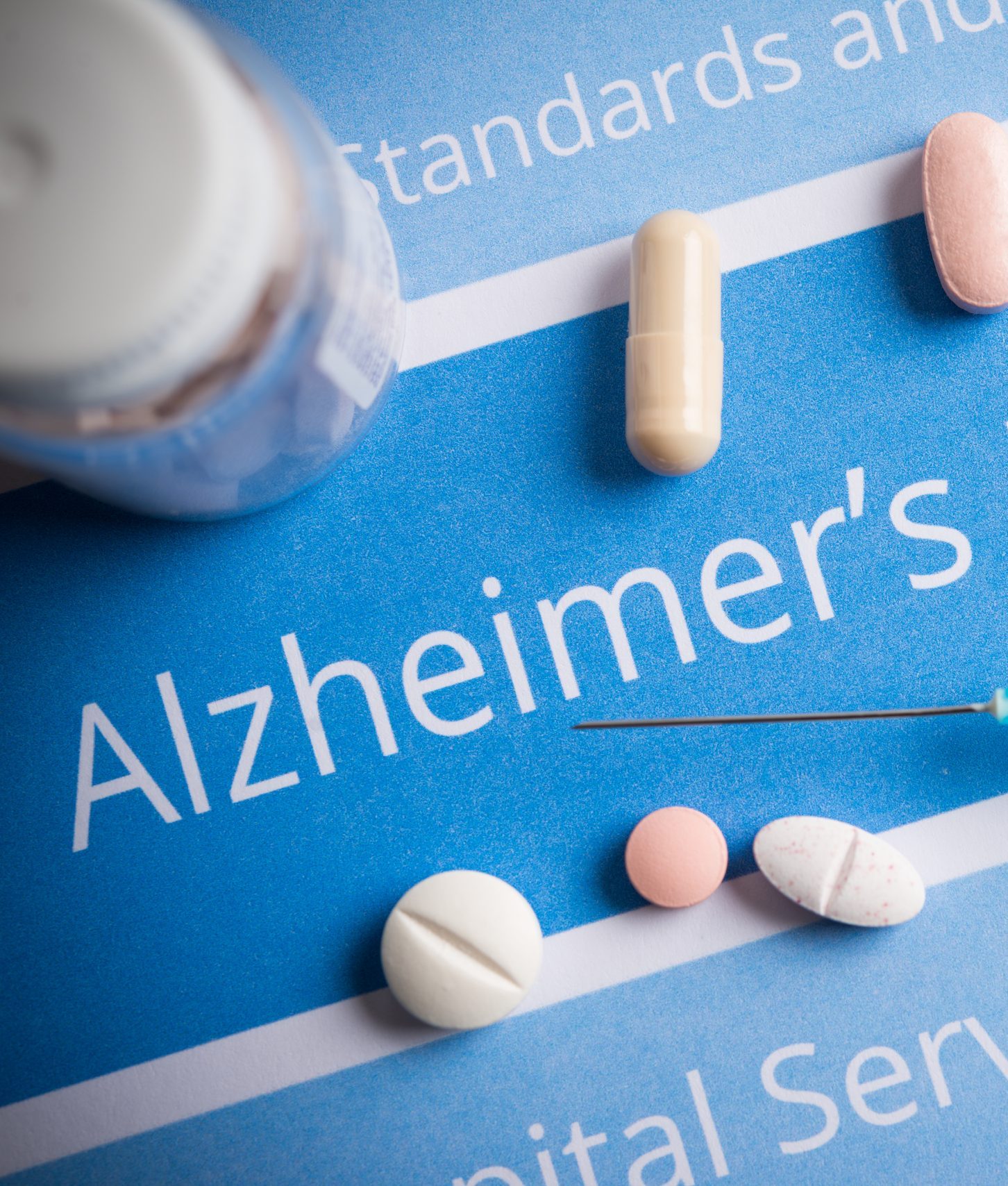 Điều trị bệnh Alzheimer và tiên lượng bệnh