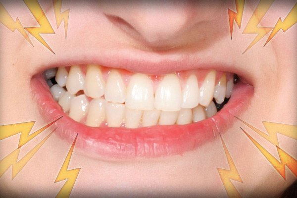 Nghiến răng: Nguyên nhân, dấu hiệu, ảnh huởng và hướng điều trị