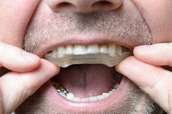 Nghiến răng: Nguyên nhân, dấu hiệu, ảnh huởng và hướng điều trị