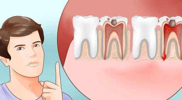 Đau nhức răng: Nguyên nhân, cách điều trị và phòng ngừa