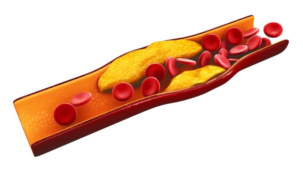 Bạn đã biết đến vai trò của cholesterol trong cơ thể chưa?