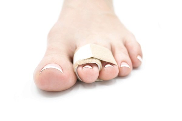 Gãy xương ngón chân: Những điều bạn cần biết