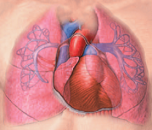 Những điều bạn cần biết về tăng áp phổi