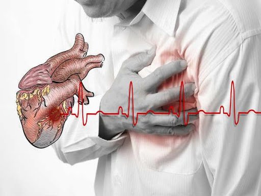 Ngưng tim đột ngột: Dấu hiệu, nguyên nhân, chẩn đoán, điều trị