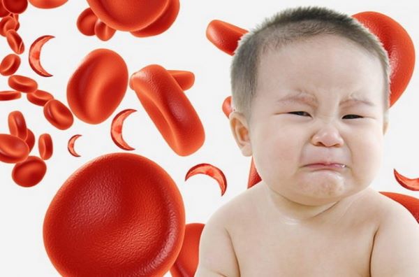 Trẻ bị thiếu máu: Những điều bố mẹ cần biết