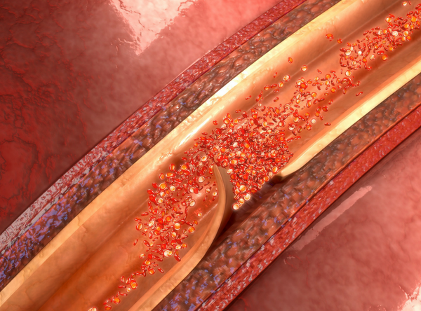 Loạn sản sợi cơ: Dấu hiệu, Nguyên nhân, Chẩn đoán và Điều trị