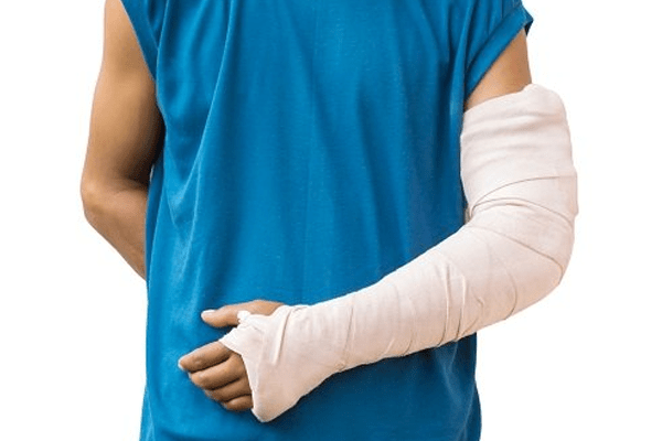 Trật khuỷu tay: Nguyên nhân, chẩn đoán và điều trị