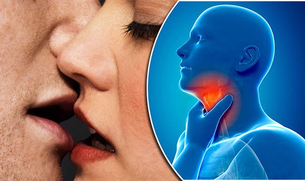 Tăng bạch cầu đơn nhân nhiễm khuẩn: căn bệnh lây qua nụ hôn