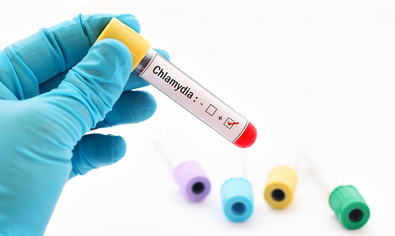 Chlamydia và vô sinh: Giải đáp các thắc mắc cùng bác sĩ