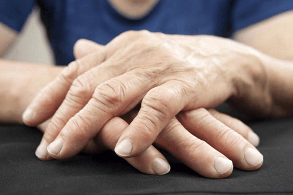 Sưng khớp ngón tay: những điều bạn cần biết