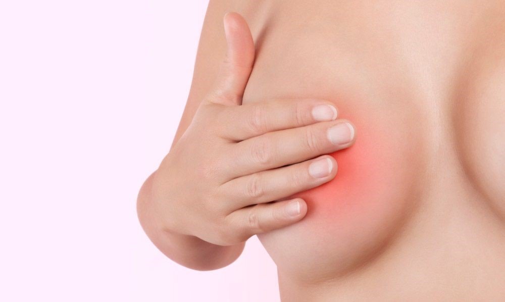Sờ thấy khối ở vú và 7 nguyên nhân thường gặp