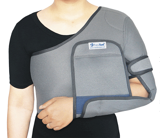 Gãy xương cánh tay: Nguyên nhân, triệu chứng và cách điều trị