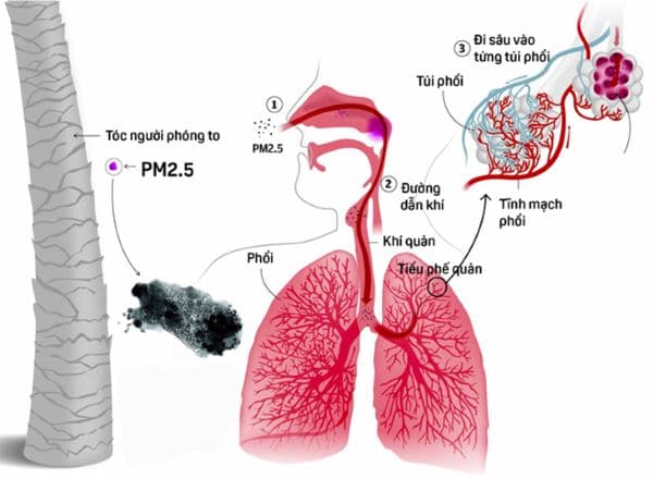 Ô nhiễm không khí, bụi mịn PM2.5 gây hại thế nào tới sức khỏe?